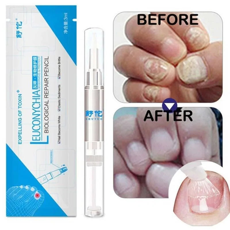 Fungus Treatment Repair Pencil