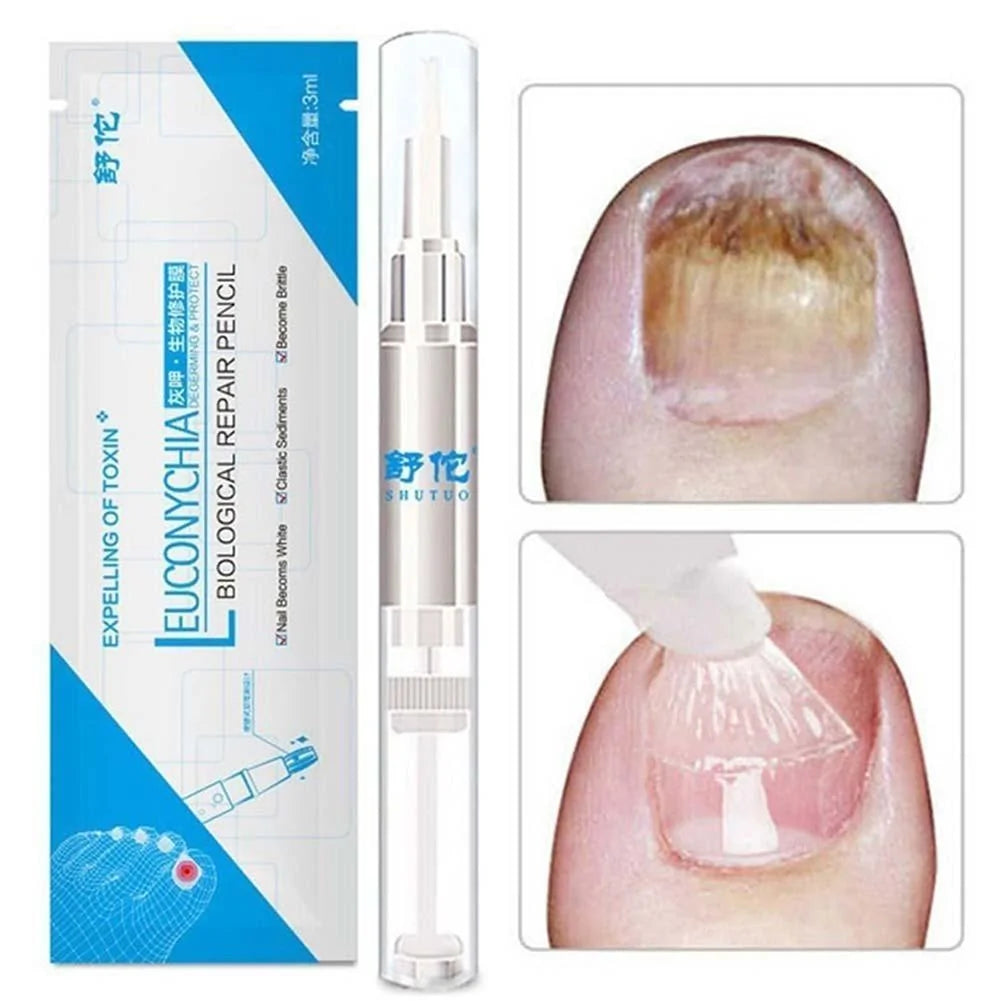 Fungus Treatment Repair Pencil